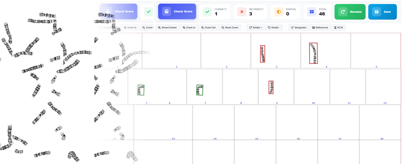 Karyotutor interactive karyotyping platform showing chromosome analysis and scoring